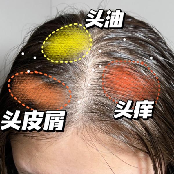 适合头痒头屑多的洗发水有哪些?去屑又止痒的洗发水排行榜 - 知乎