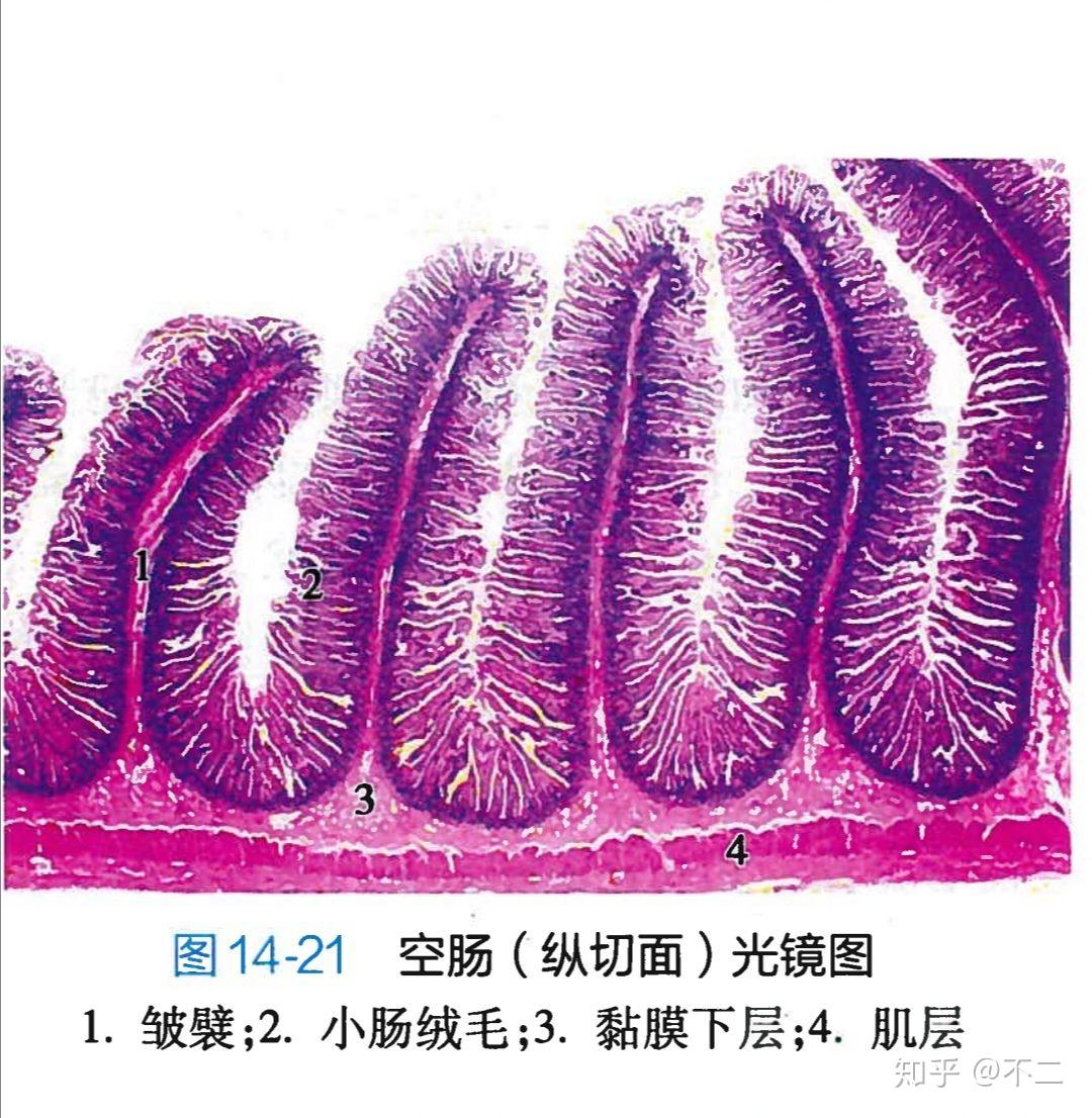 空肠弯曲菌手绘图图片