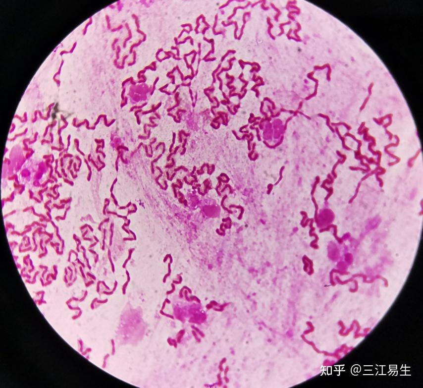 铜绿假单胞菌痰液颜色图片
