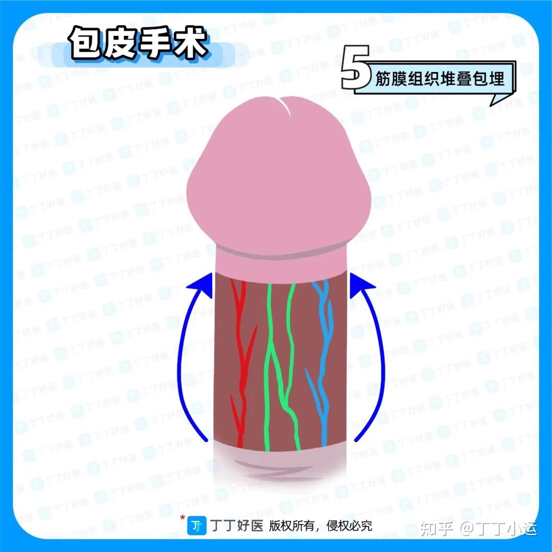 割了皮包视频教程图片