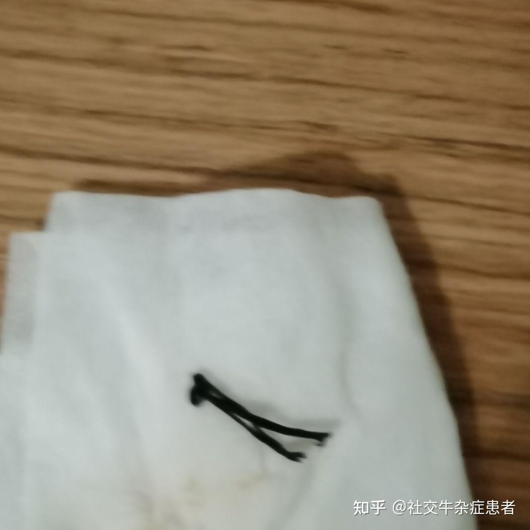 痔疮 肛裂手术记录贴(更新中) - 知乎