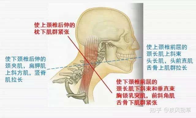 枕后腱弓的位置图图片