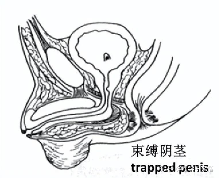 丁丁太小没什么大不了