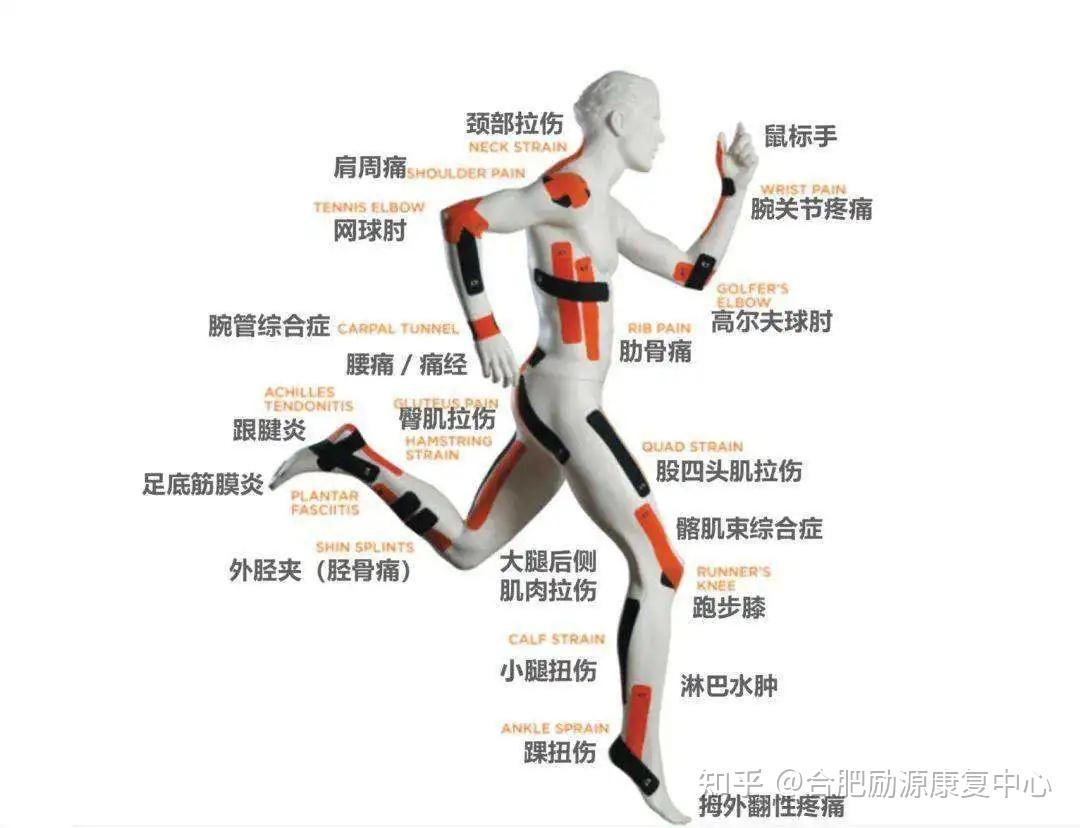 肌贴怎么用?原理是什么?一篇文章说清楚