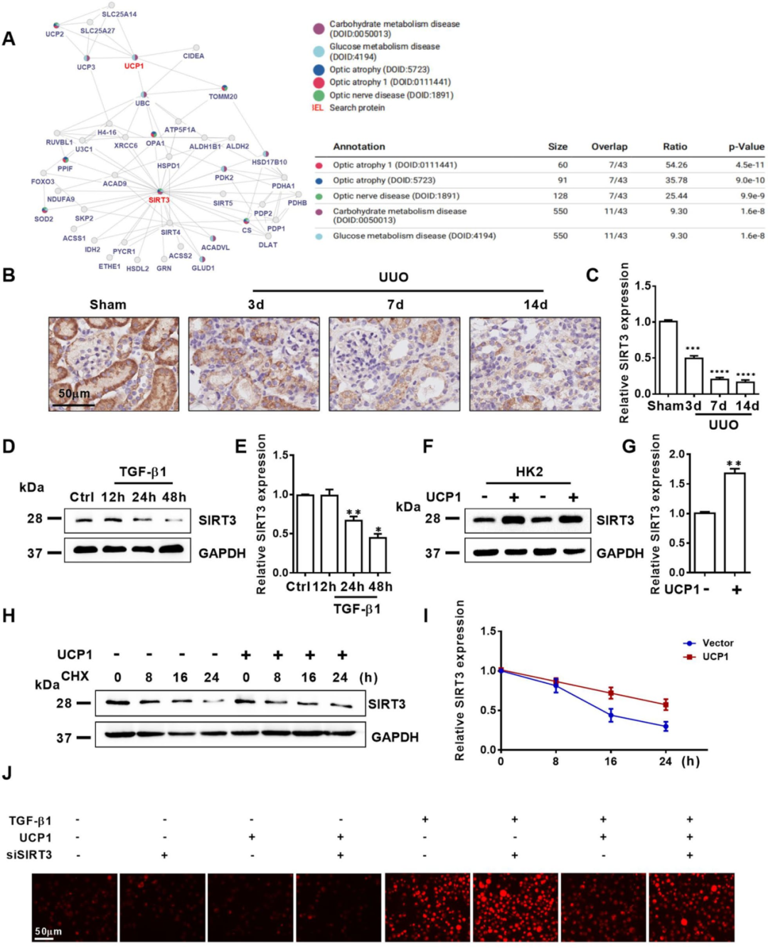 『CKD治疗新靶点』武汉协和医院张春教授团队揭示UCP1缓解肾间质纤维化进展的机制！ - 知乎