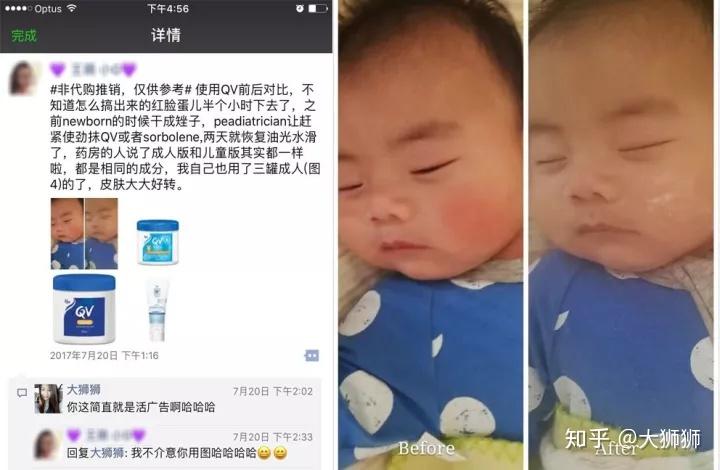 湿疹?皮炎?痱子?…15种婴儿常见皮肤病【图示指南】,别再傻傻分不清!-婴儿湿疹痱子用什么药膏