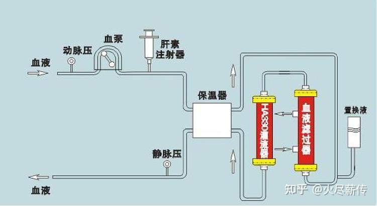 血液灌流图片示意图图片