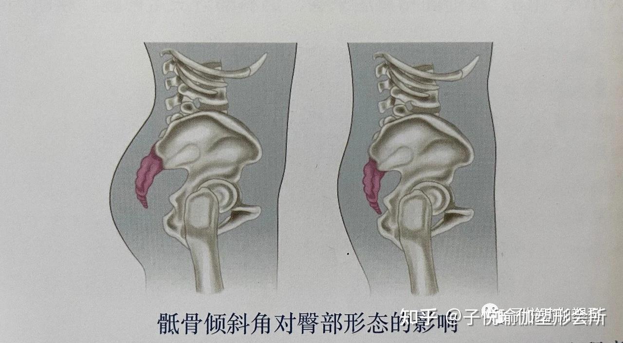 骶骨的倾斜角越大