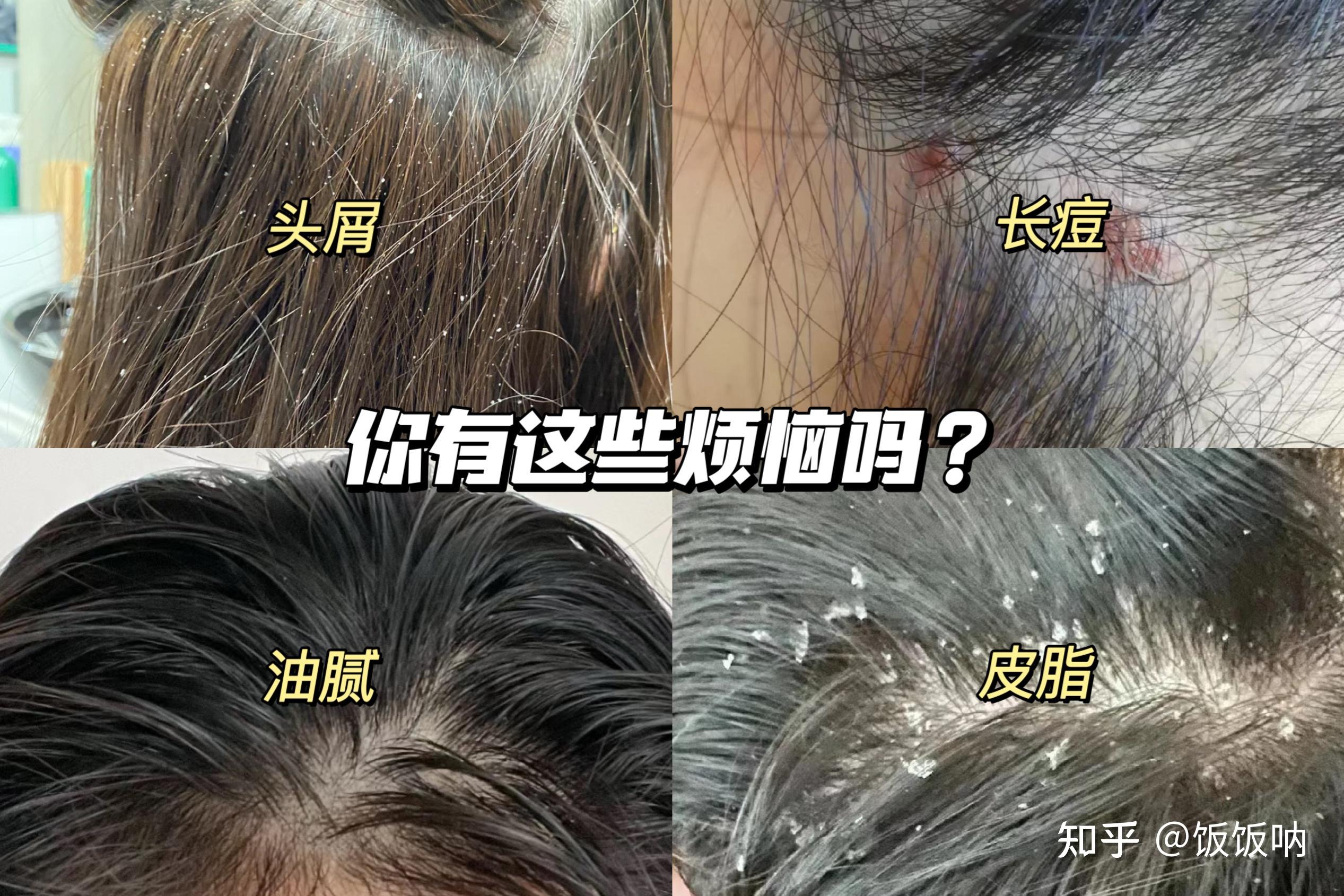 扎头发发型怎么扎 哪种简便又好看呢_伊秀视频|yxlady.com