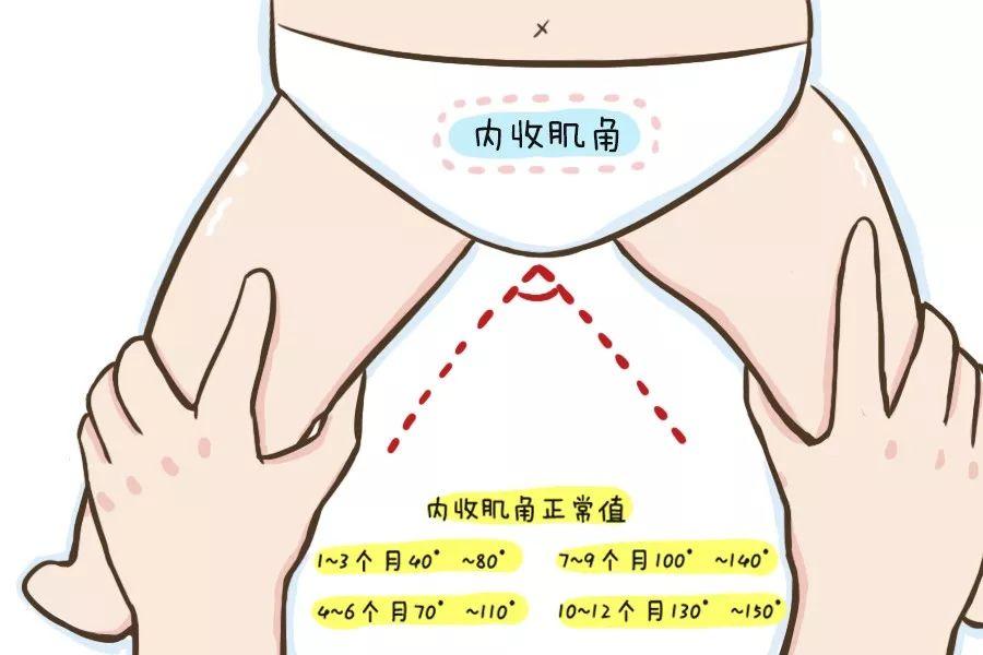 我家宝宝肌张力高网上查说是脑瘫