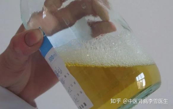 排尿酸最快的茶饮 v2-2ce89e3f5c7a66bd552eaa6388babb8a_r.jpg