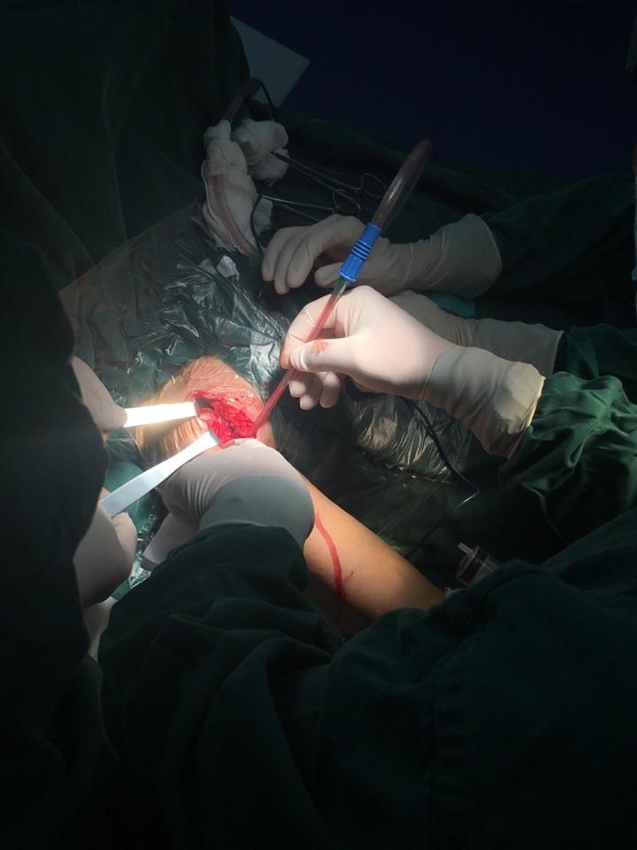 女生去做手术碰上男医生如何避免不必要的裸露尴尬