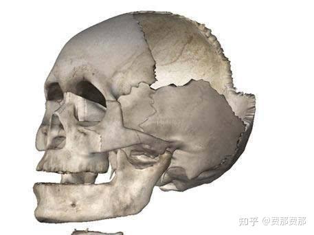 颅骨缺损可以不修补吗