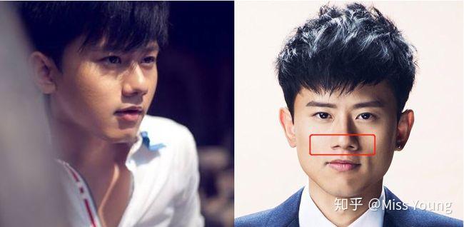 鼻孔外露怎么办