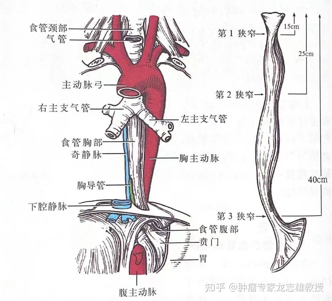 龙志雄教授:为什么会得食管癌?如何预防食管癌的发生? - 知乎
