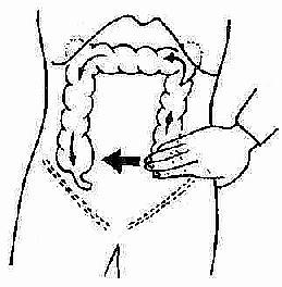 结肠充气试验(2)腰大肌征(如图:让病人左侧卧位,检查者帮助病人将右