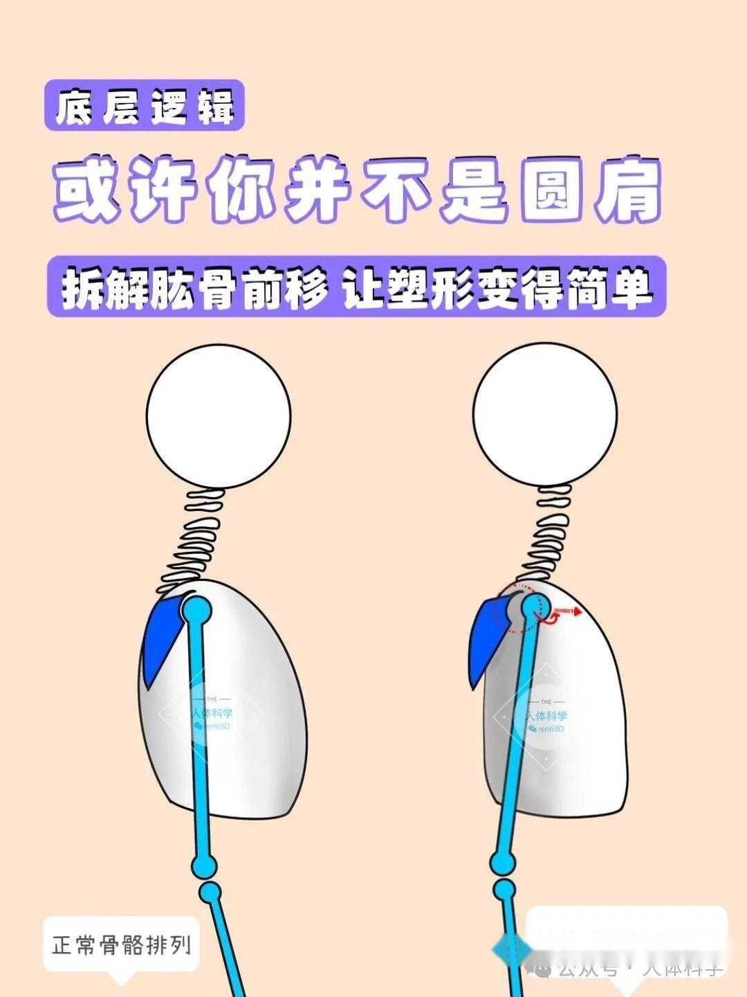 【肱骨前移】形成原因和自我改善方法 - 知乎