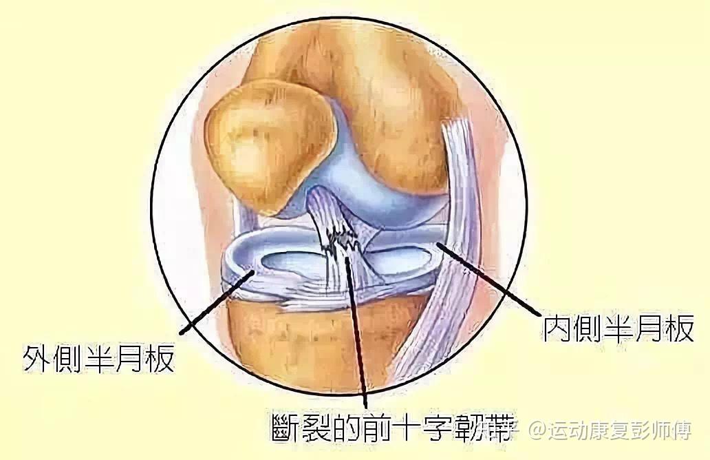 附近的肌腱韧带,以及软骨发生磨损等问题,当然如果有再往深处的钙化
