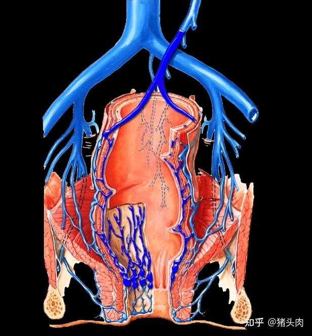患有痔疮,自己该做哪些事情