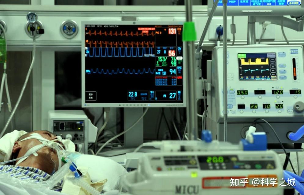 18天花掉113万,ICU到底是治病救人,还是“捞钱工具”?凭啥这么贵 知乎