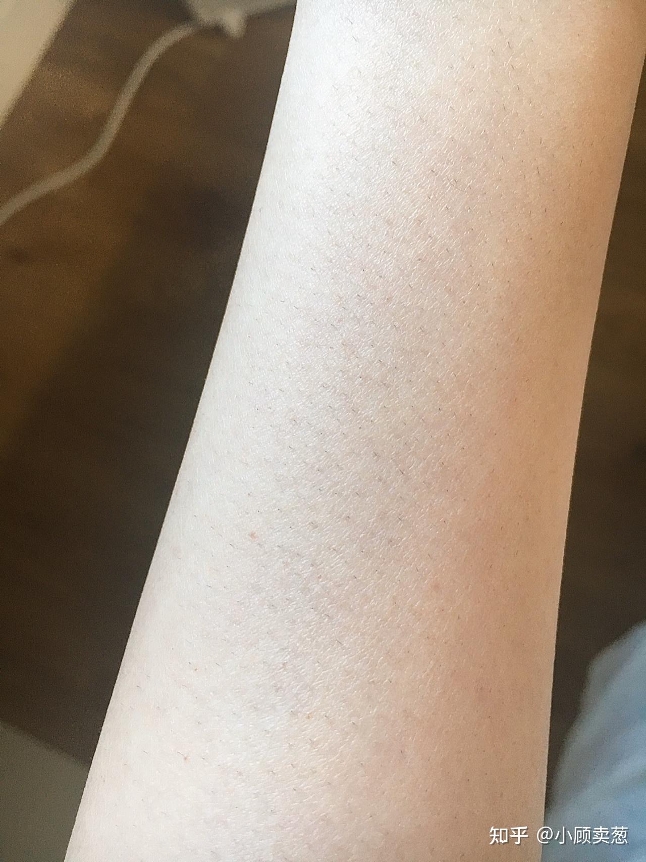 谁知道怎么才能脱毛