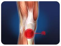 髌腱断裂对于一个体育生来说意味着什么
