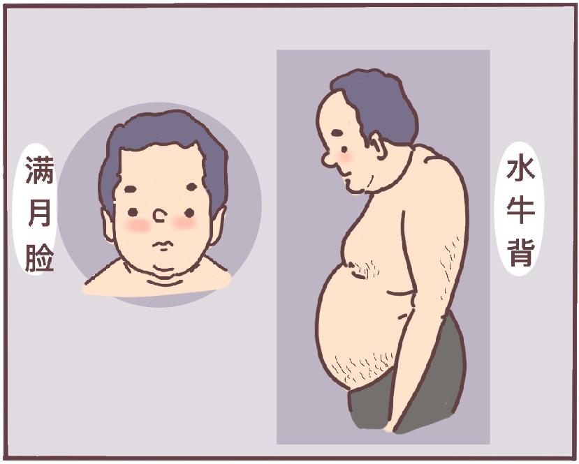 鼻子,下巴变大,应警惕肢端肥大症疾病特点:患者会有颧骨突出,额头