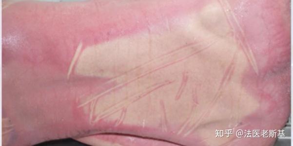 90的人都不知道人死后为何会遍体鳞伤