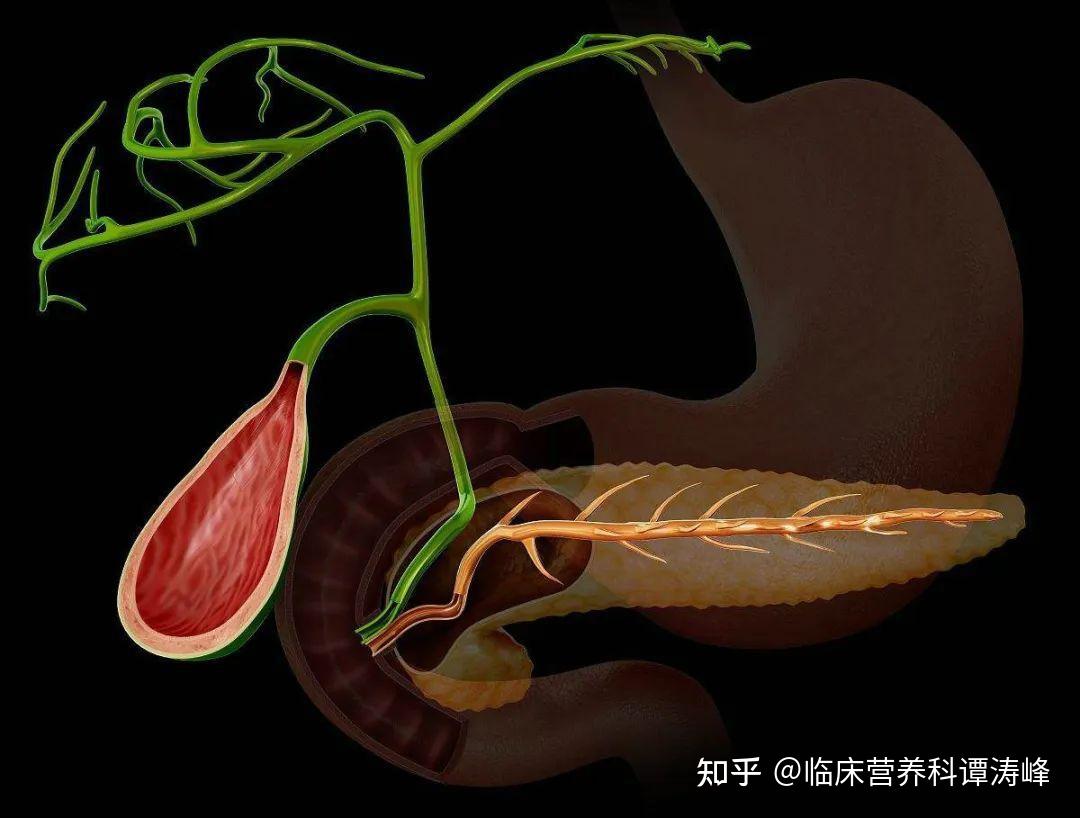 小心血糖异常和胰腺癌有关!医生提醒:暴瘦不要忽视 - 知乎