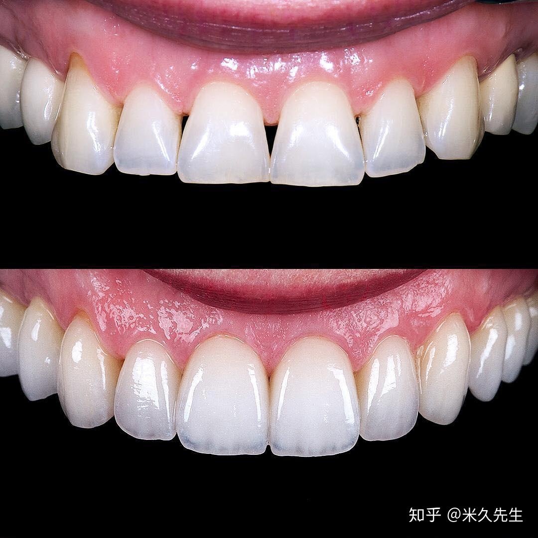 牙齿修复平面广告素材免费下载(图片编号:4807259)-六图网