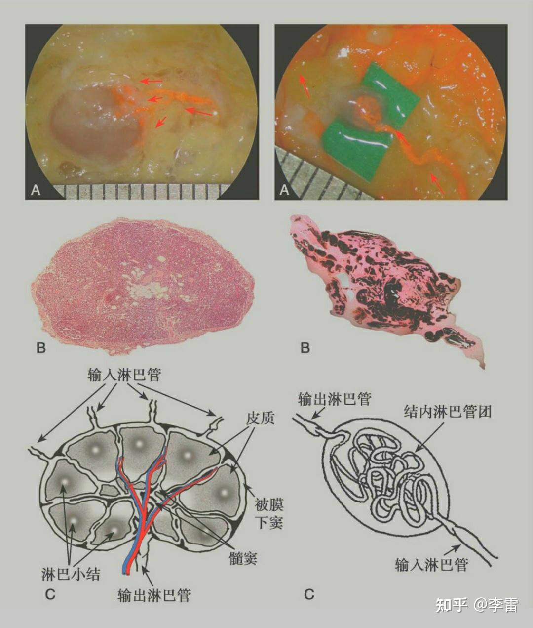 淋巴结组织切片图图片