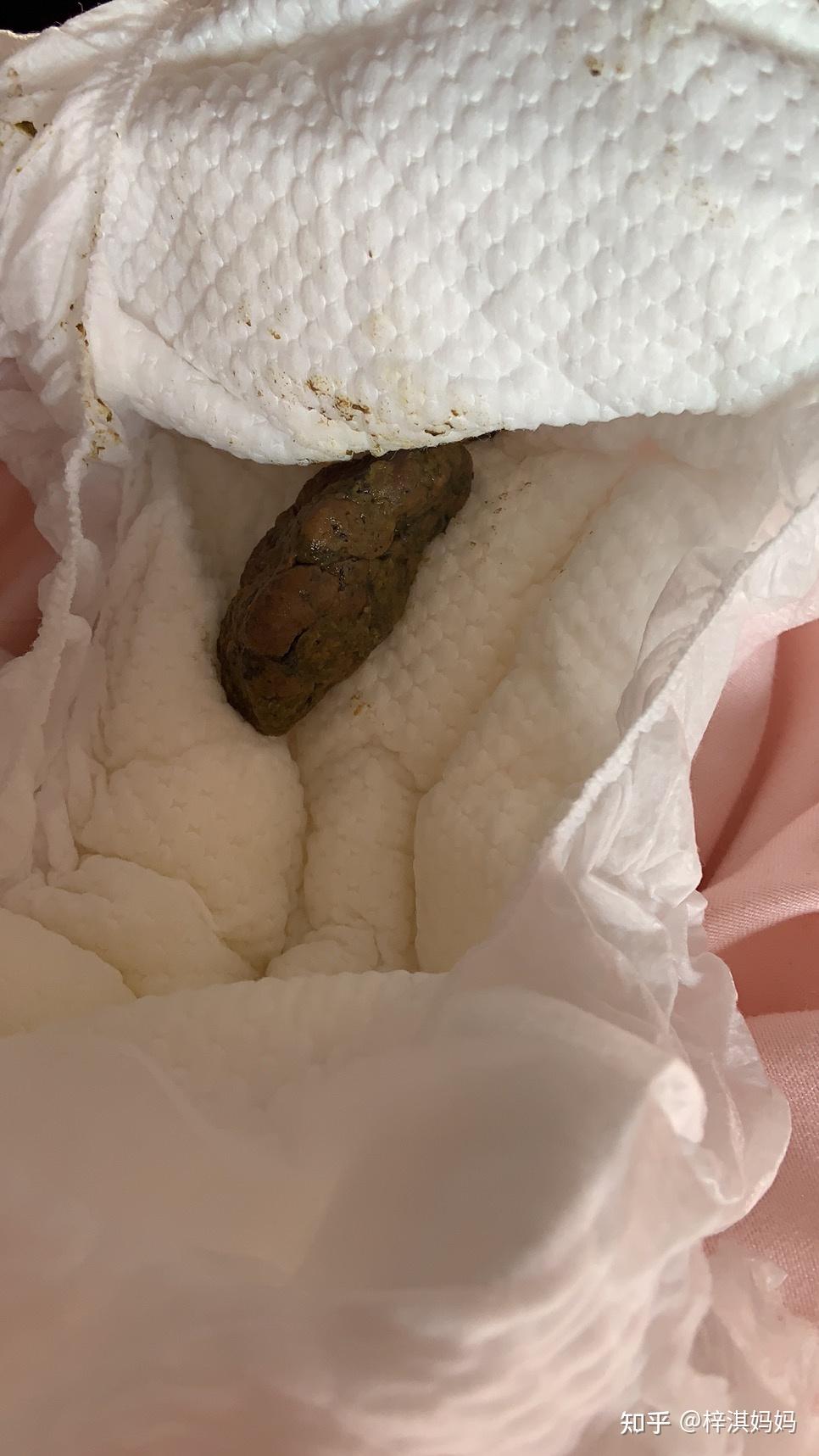 过敏宝宝腹泻粘液便的经历