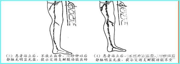 pratt试验图片