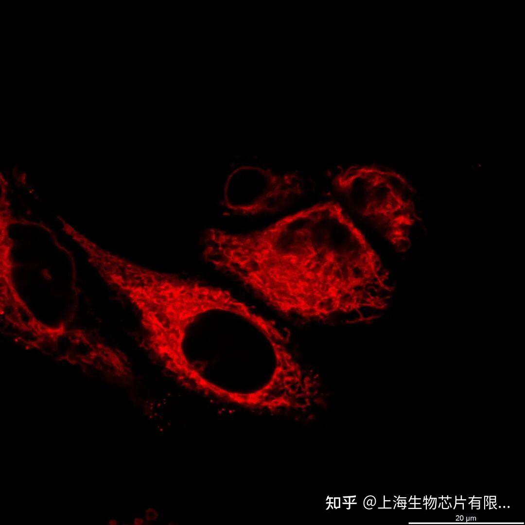 Dapi 405 亚细胞结构超高分辨显微成像系列——内质网 - 知乎