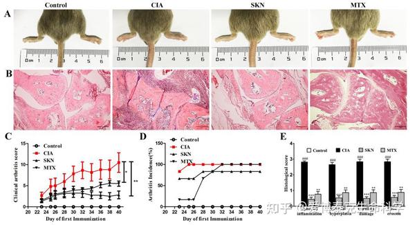 中毒性滑膜炎に伴う合併症にはどのようなものがありますか?