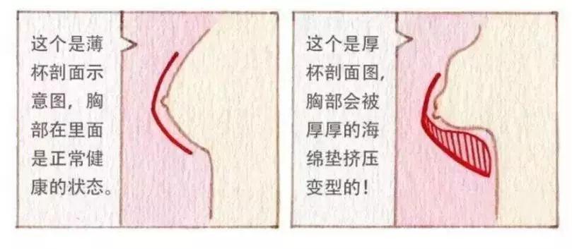 长期下来容易形成副乳,让胸部轮廓松散,形成外扩和下垂