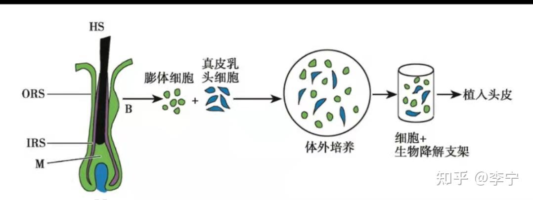 毛囊细胞克隆与再生医学