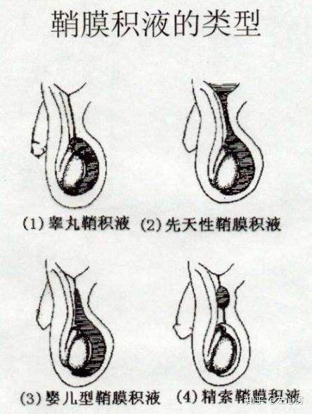 為什麼兩個睪丸一大一小呢