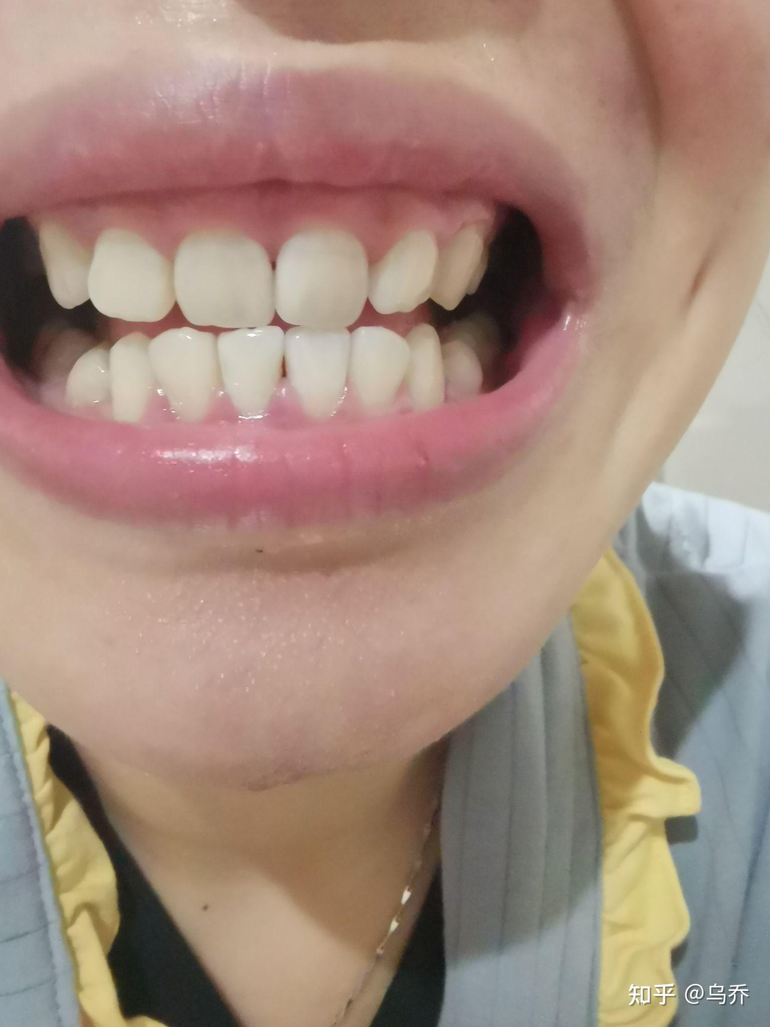 电动牙刷是交智商税吗?