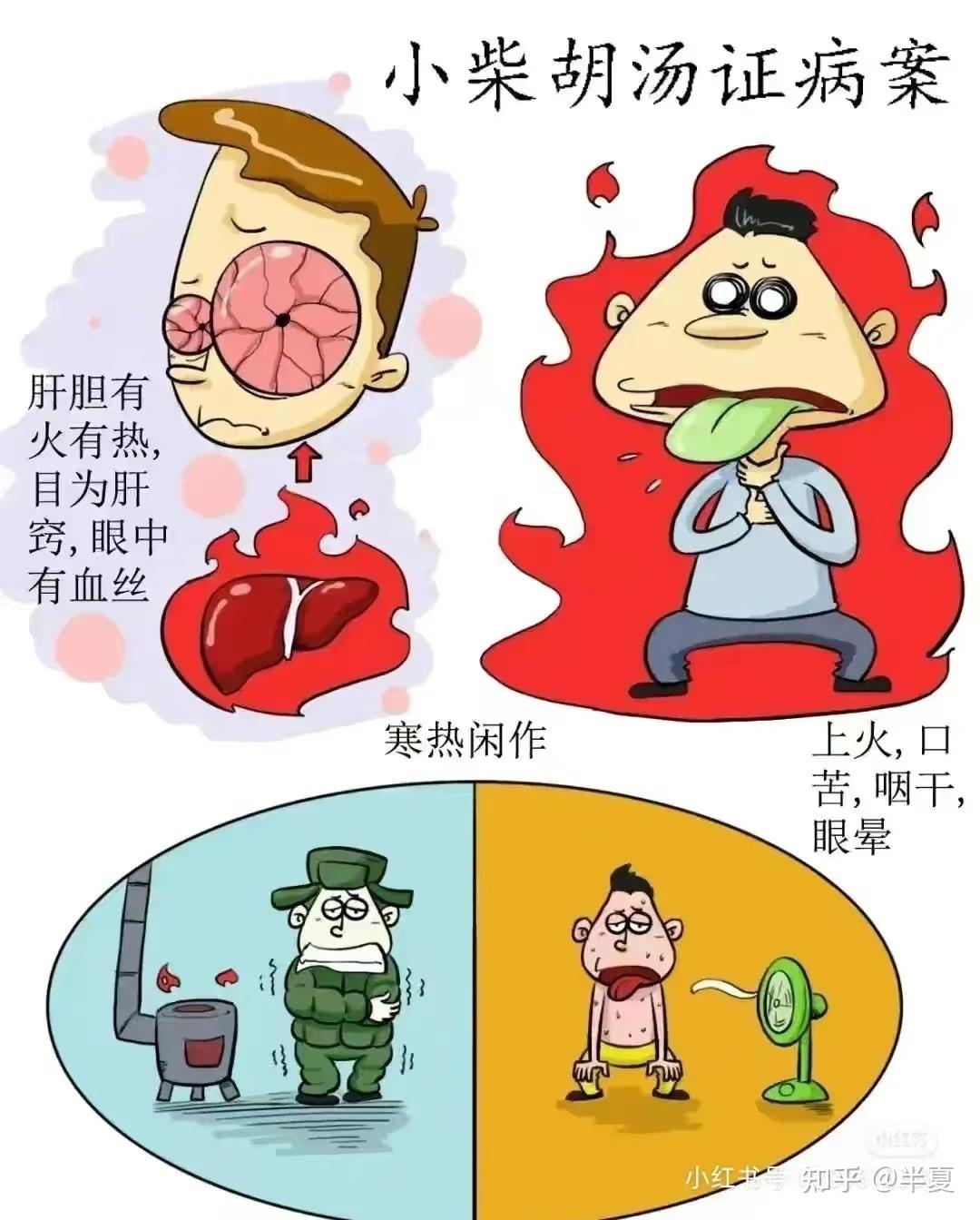 伤寒论之少阳病 - 知乎