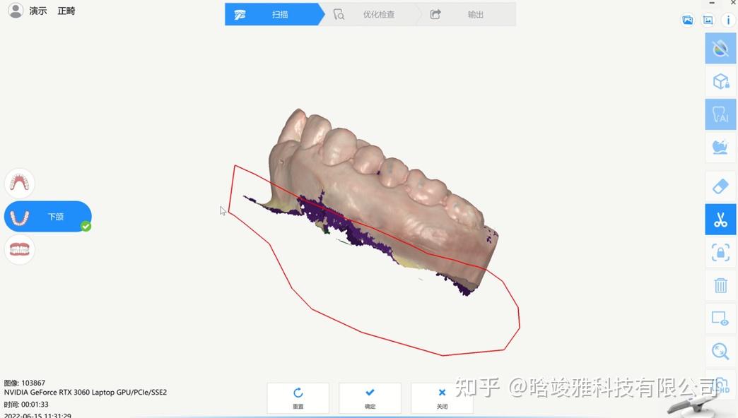 口扫有哪些智能工具 - 知乎