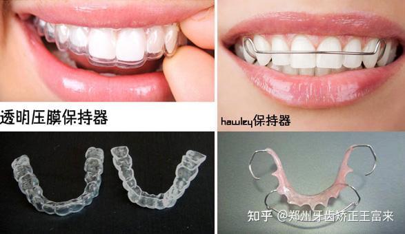 对于矫治器来说,很多朋友选择的标准就是时间快慢,所以我们就来说说