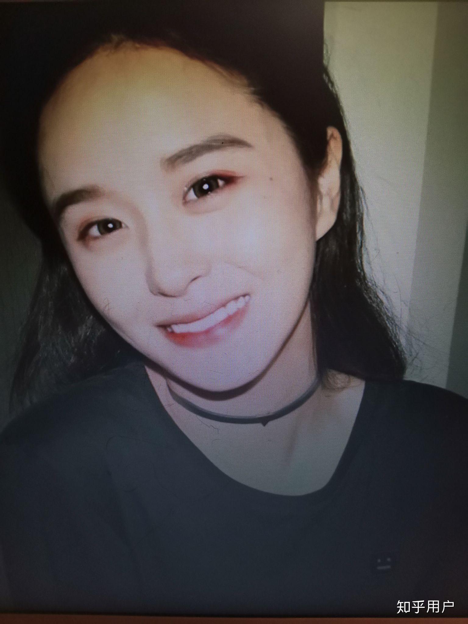 抖音里叫steph的网红动过刀子吗