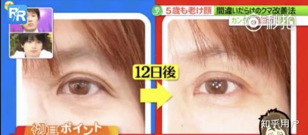 如何把皮肤养好 知乎 野菜护肤 19 08 27 谢邀 养肤是个比较大的问题 但是解决的办法基本上都是小要点 掌握这些小要点 皮肤会越养越好 每天更新一个皮肤问题和对应护理技巧 欢迎探讨 小声 希望大家收藏的同时也点个赞好嘛朋友们 Fighting