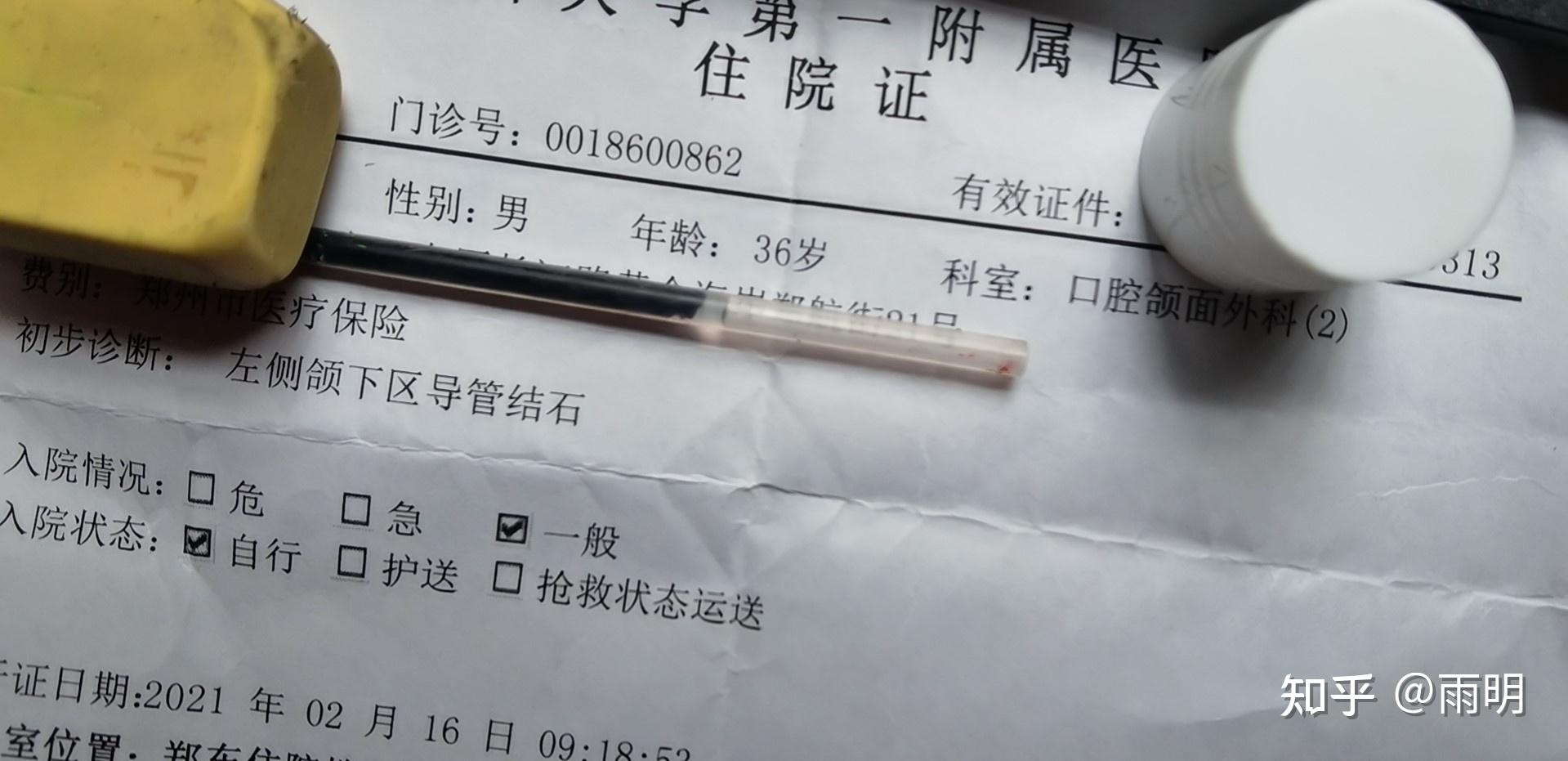 武漢大學口腔醫院顳下頜科就醫記頜下腺導管結石涎腺鏡取石記