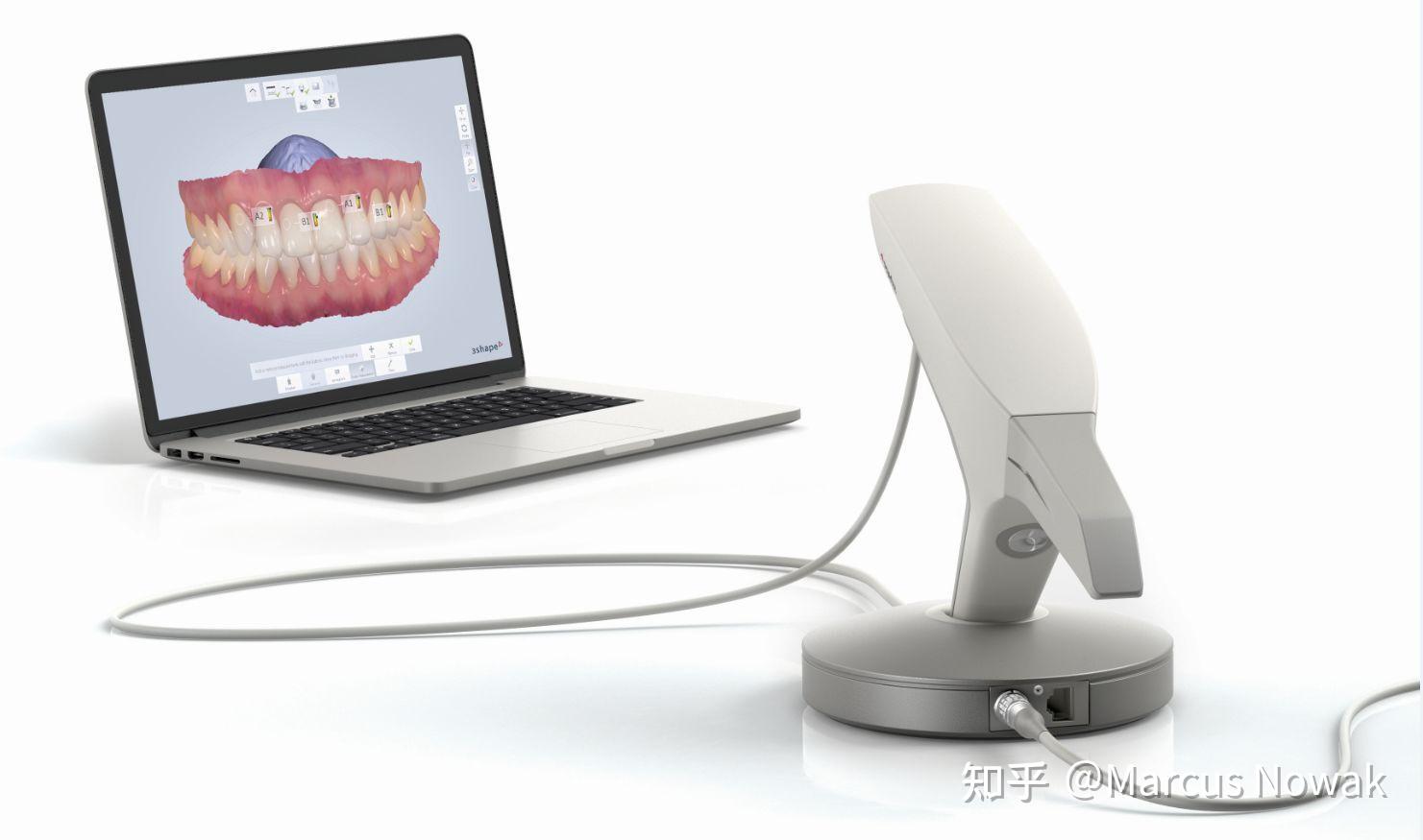 口扫:数字化“黑科技”,竟然能让种植牙轻松又省时? - 知乎
