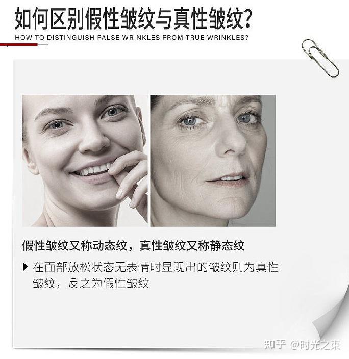 皱纹也分真假?弄清这两点,淡化皱纹更高效 - 知乎