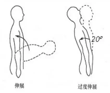 罗马椅挺身,真是个安全的好动作吗?