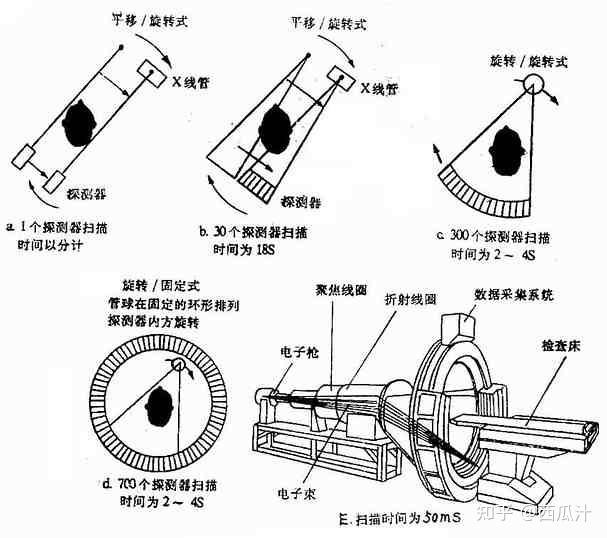 CT简介 - 知乎