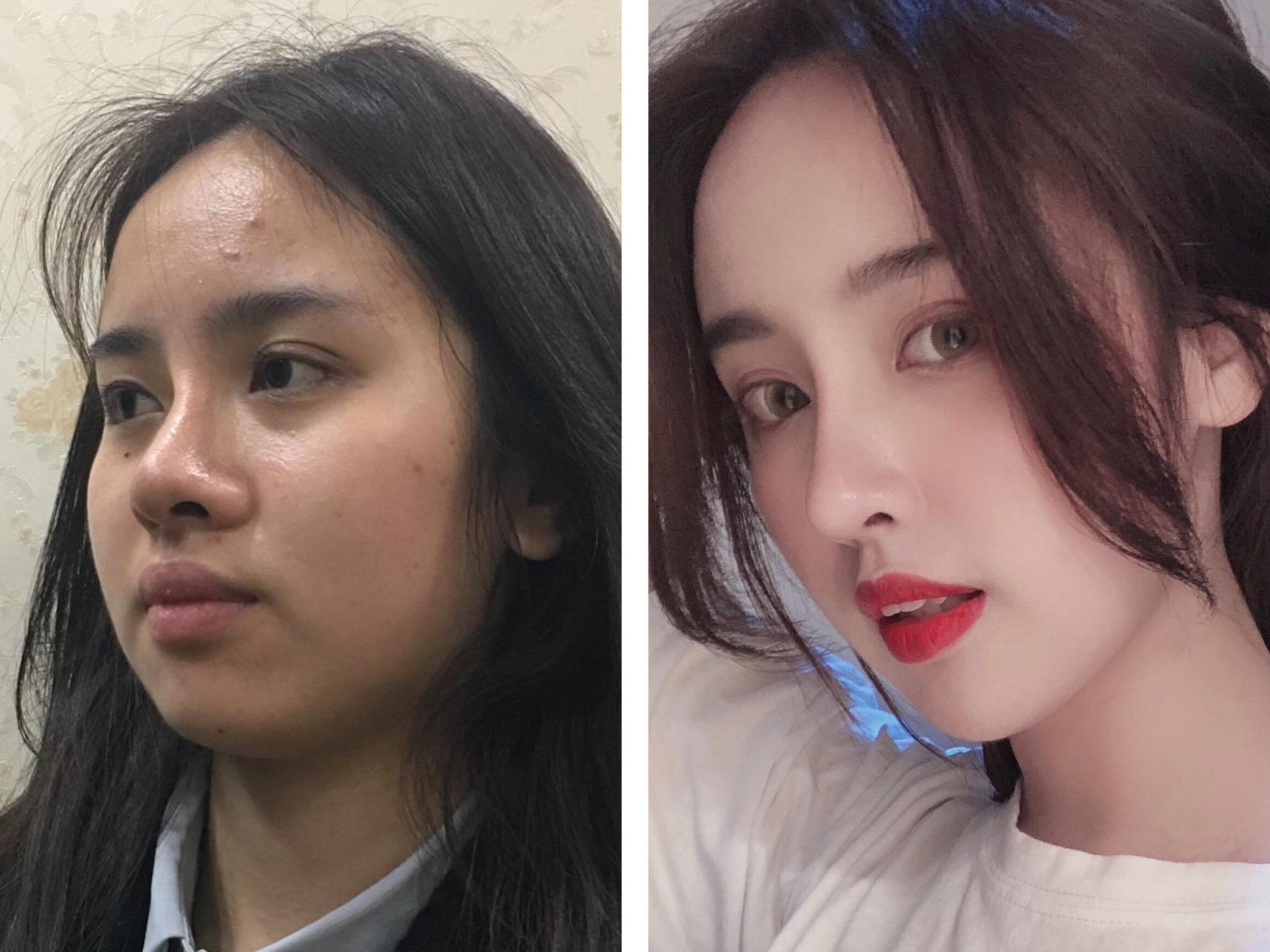 31岁的杨幂脸崩的太厉害磨骨削骨的后遗症原来是这样